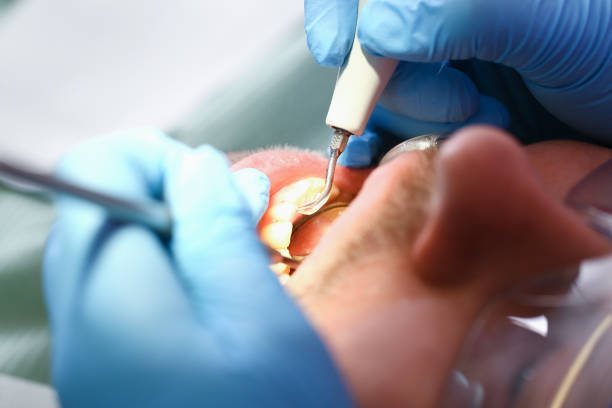 Best Emergency Dental Care for Broken or Chipped Teeth in Alvarado, TX