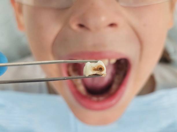 Best Weekend Emergency Dentist in Alvarado, TX