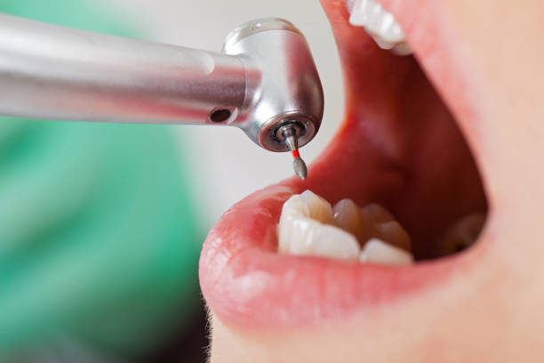 Best Emergency Gum Treatment in Alvarado, TX